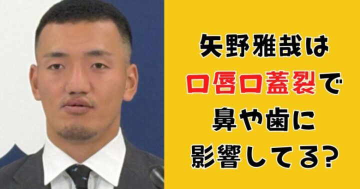 矢野雅哉は口唇口蓋裂で鼻や歯に影響してる?兄弟も病気だった?